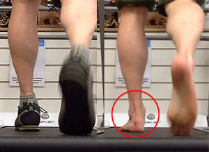 Gait analysis